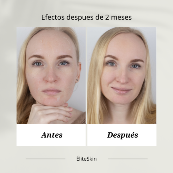 terapia 10min