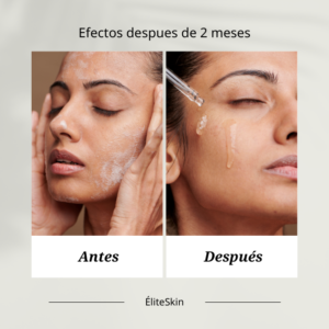 terapia