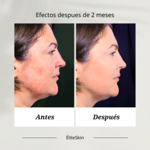 terapia anti-edad