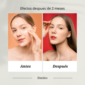 terapia antioxidante
