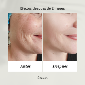 terapia-argan
