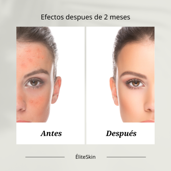 terapia duo serum