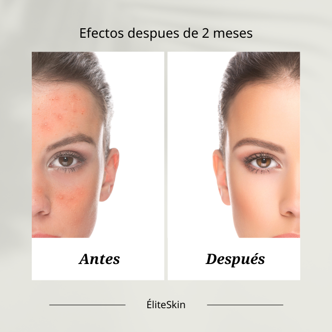 terapia duo serum