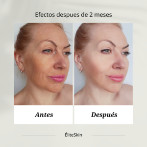 terapia gold