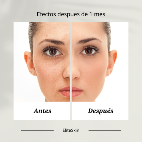 terapia retinol